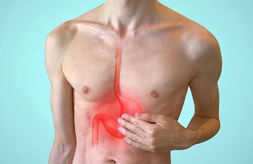 Esta imagem mostra o estomago área do corpo afetada pela gastrite crônica