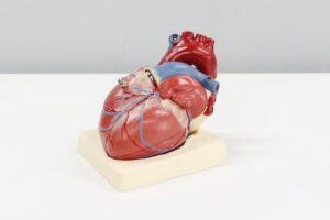 Foto de um coração para ilustrar a explicação do infarto, quando o coração sofre privação de oxigênio por alguma obstrução nas artéria.