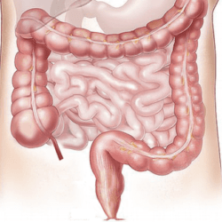 intestino grosso